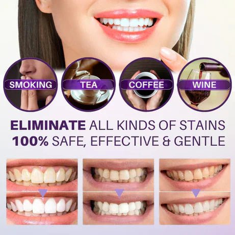 Hismile v34 Color Corrector Serum - Instant Teeth Whitening - Handy - Things