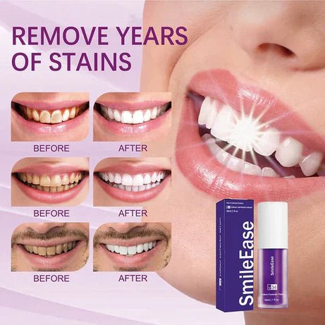 Hismile v34 Color Corrector Serum - Instant Teeth Whitening - Handy - Things